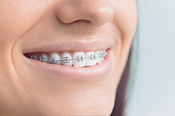 Best Dental Fillings (Composite and Amalgam)  in Muscle Shos, AL
